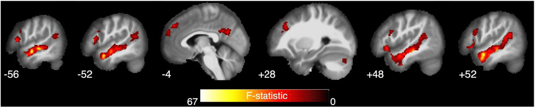 Auditory dyadic interactions through the “eye” of the social brain: 图像