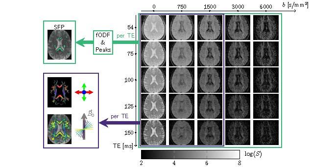 Kleban, E., Jones, D. K., & Tax, C. M. W. (2023). The Impact of Head Orientation with Respect image