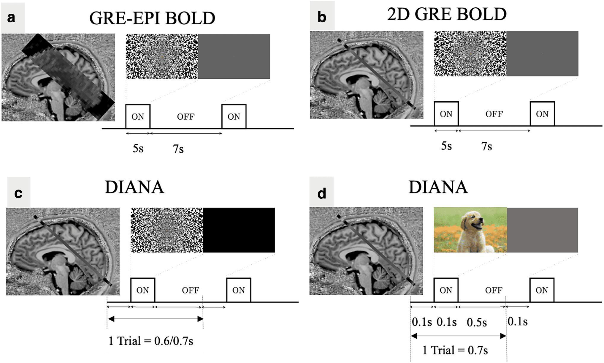 Experiencias iniciales con imágenes directas de la actividad neuronal. (DIANA) imagen