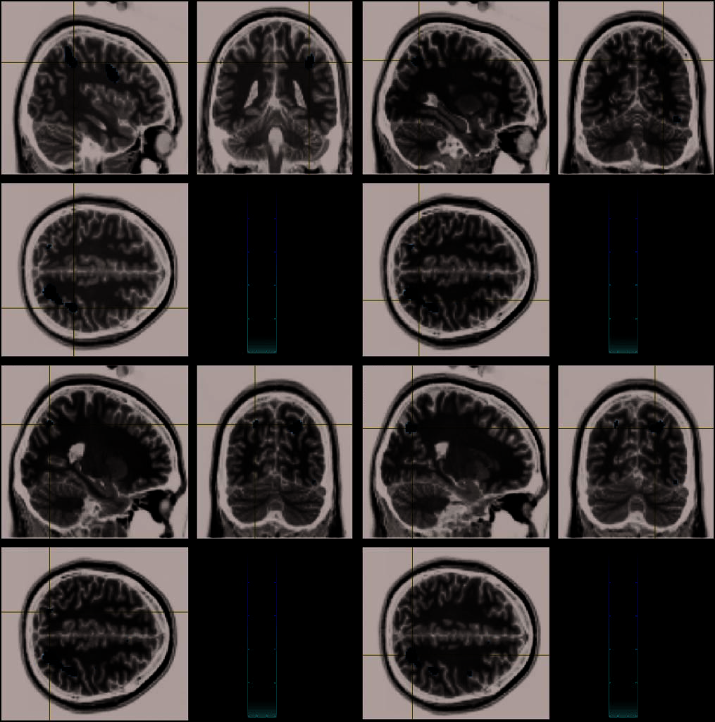 Imaging Informational Conflict: A Functional image