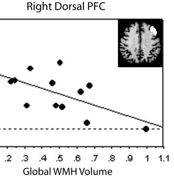 White Matter Changes Compromise Prefrontal Cortex image