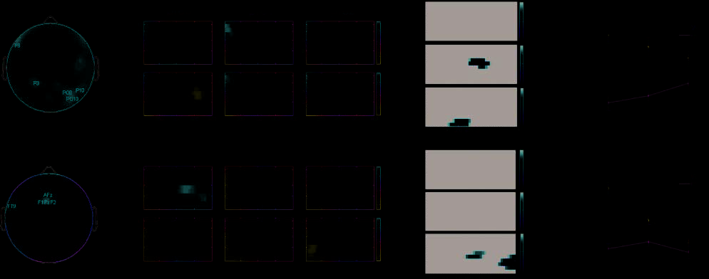 Dissociable Neural Mechanisms for Encoding image