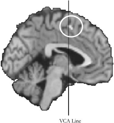 Manipulating the Experienced Onset of Intention image