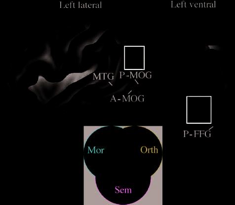 Neural Correlates of Morphological Decomposition image