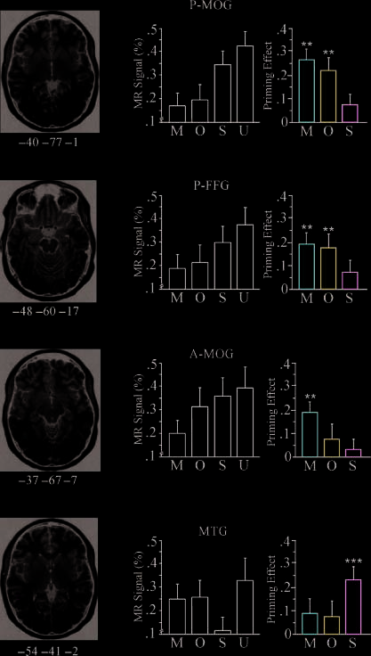 Neural Correlates of Morphological Decomposition image