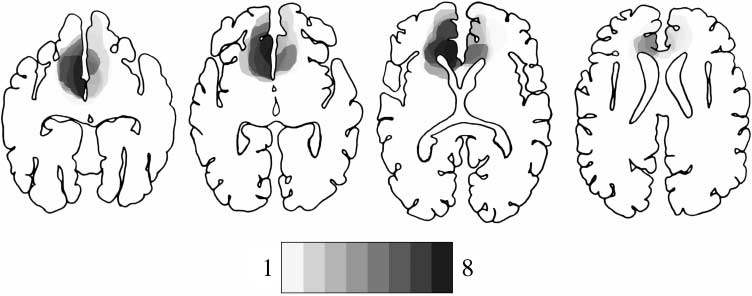 The Regulation of Cognitive Control following Rostral image