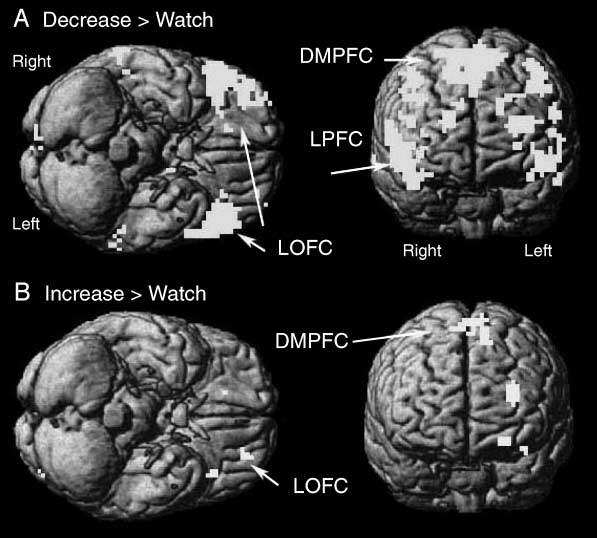 Neural Correlates of Positive and Negative image