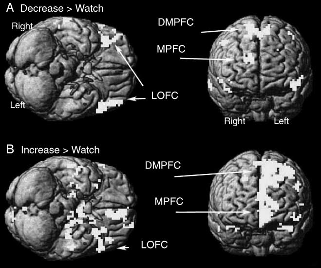 Neural Correlates of Positive and Negative image