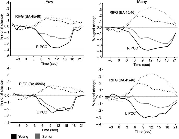 Age Differences in Deactivation: Bild