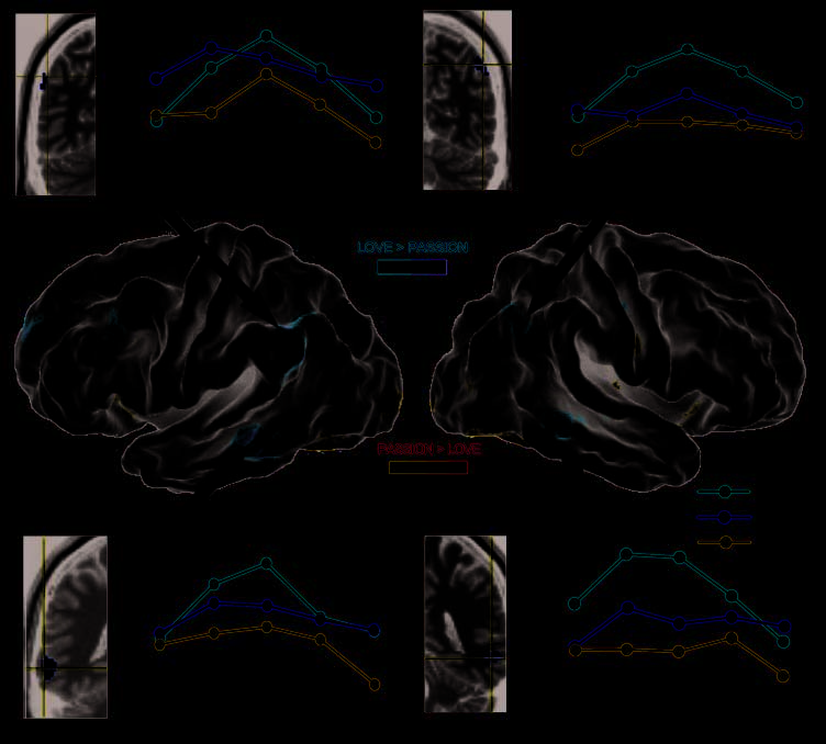 The Neural Basis of Love as a Subliminal Prime: Bild