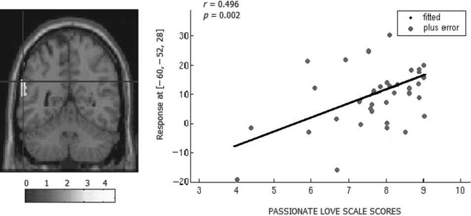 The Neural Basis of Love as a Subliminal Prime: Bild