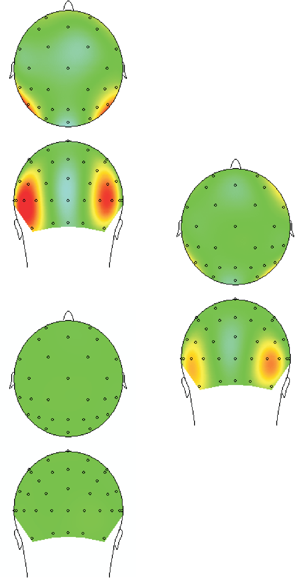 Masking Disrupts Reentrant Processing image