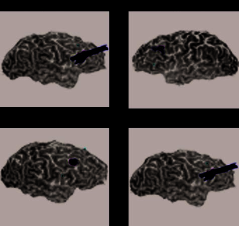 Processing Nouns and Verbs in the Left Frontal image