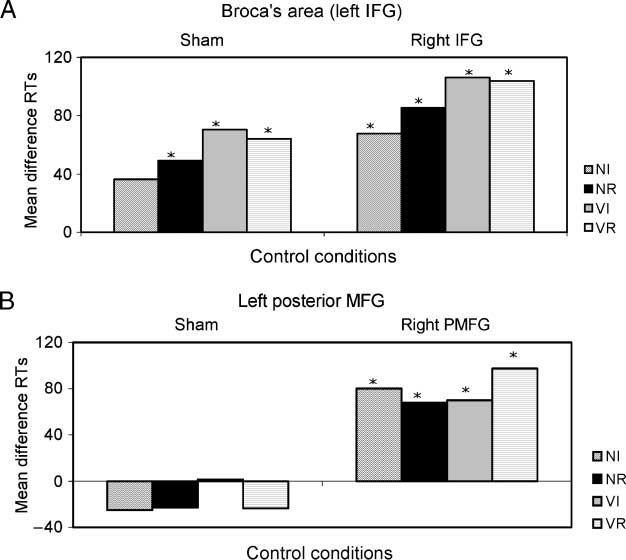 Processing Nouns and Verbs in the Left Frontal image