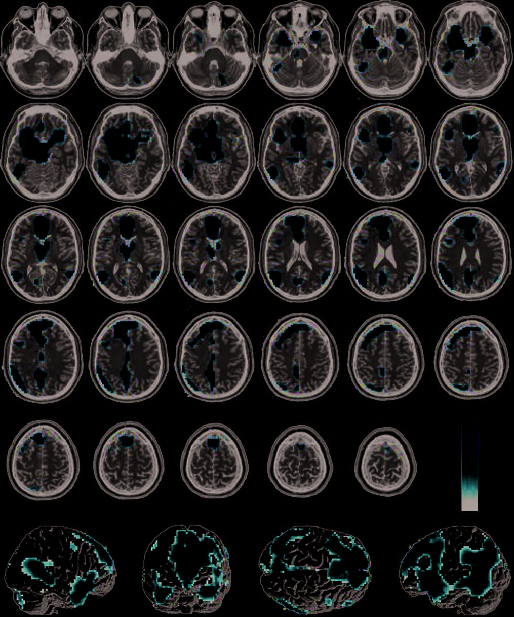 Infection, Incest, and Iniquity: Investigating the image