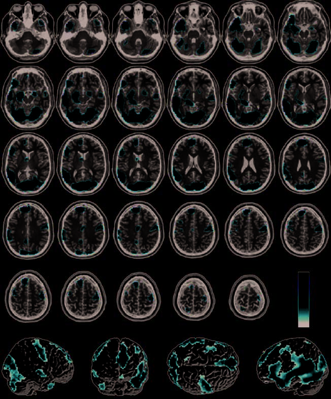 Infection, Incest, and Iniquity: Investigating the image