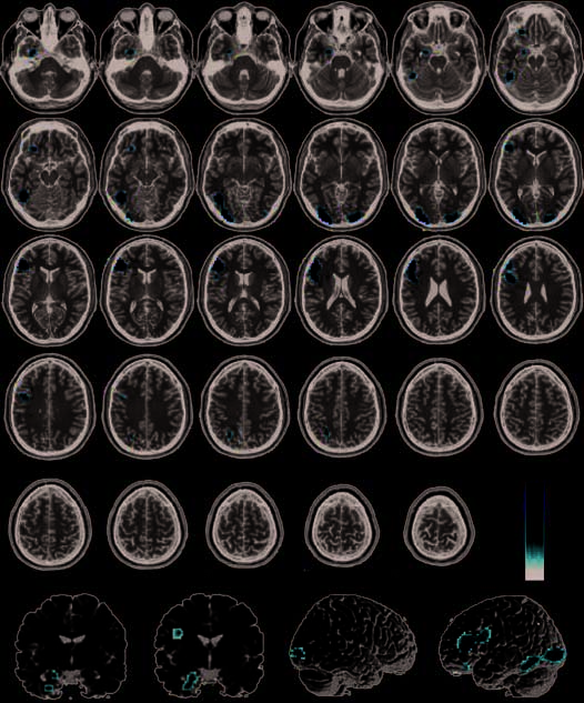 Infection, Incest, and Iniquity: Investigating the image