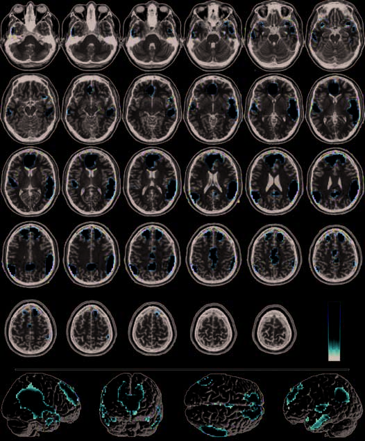 Infection, Incest, and Iniquity: Investigating the image