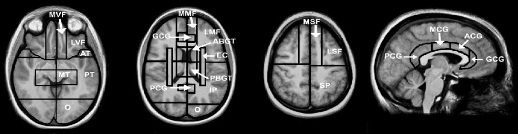 Autobiographical Memory and Patterns of Brain image