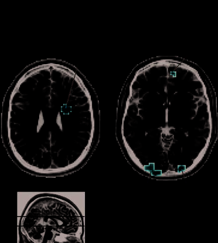 Brain Responses to Biological Relevance image