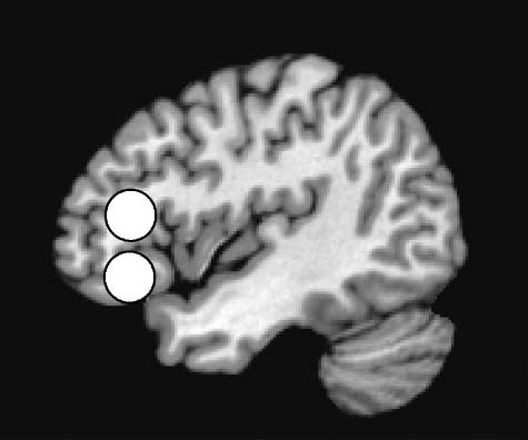 When Elephants Fly: Differential Sensitivity of Right image