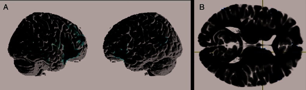 When Elephants Fly: Differential Sensitivity of Right image