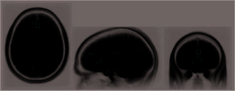 A Brain Mechanism for Facilitation of Insight image