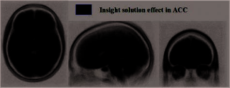 A Brain Mechanism for Facilitation of Insight image