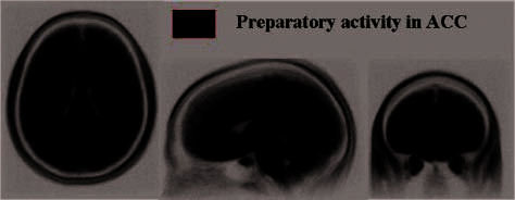 A Brain Mechanism for Facilitation of Insight image