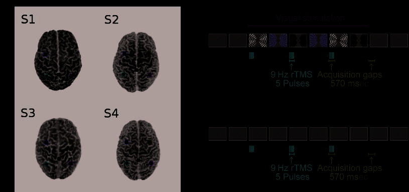 Hemispheric Differences in Frontal and Parietal image