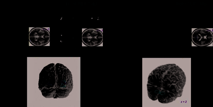 Hemispheric Differences in Frontal and Parietal image