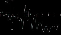 Cross-modal Emotional Attention: Emotional Voices image