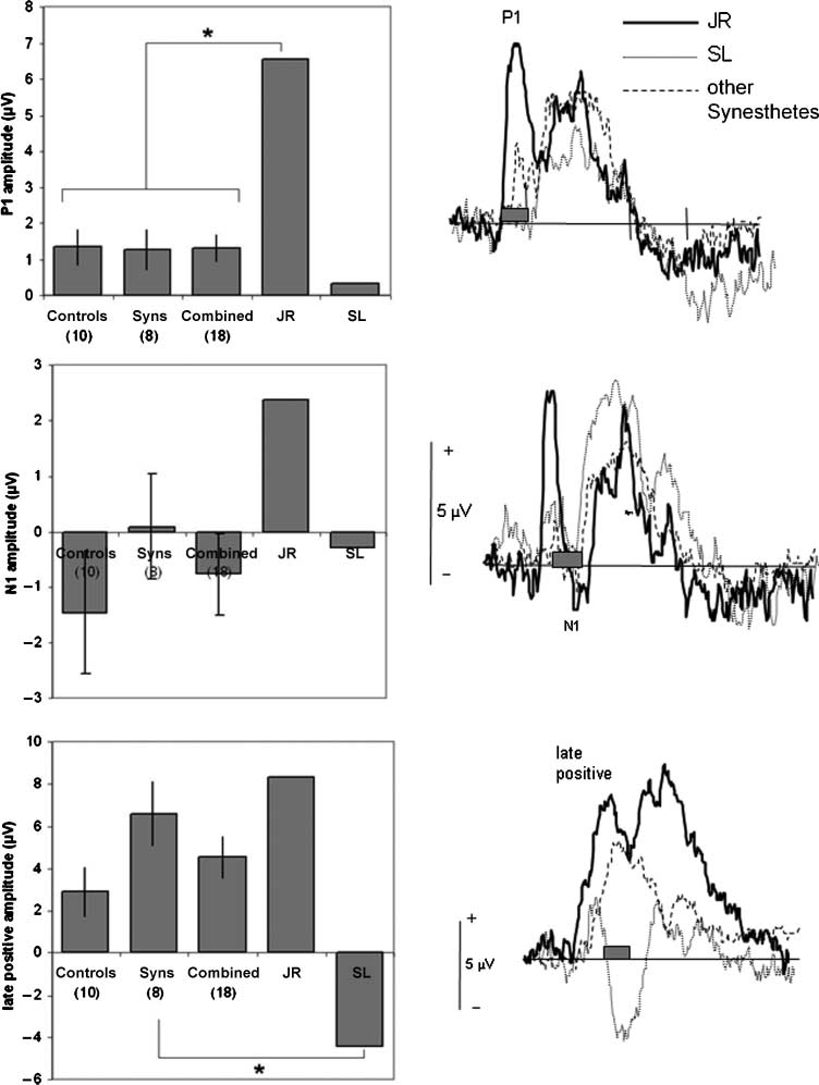 Seeing Sounds and Hearing Colors: An Event-related image