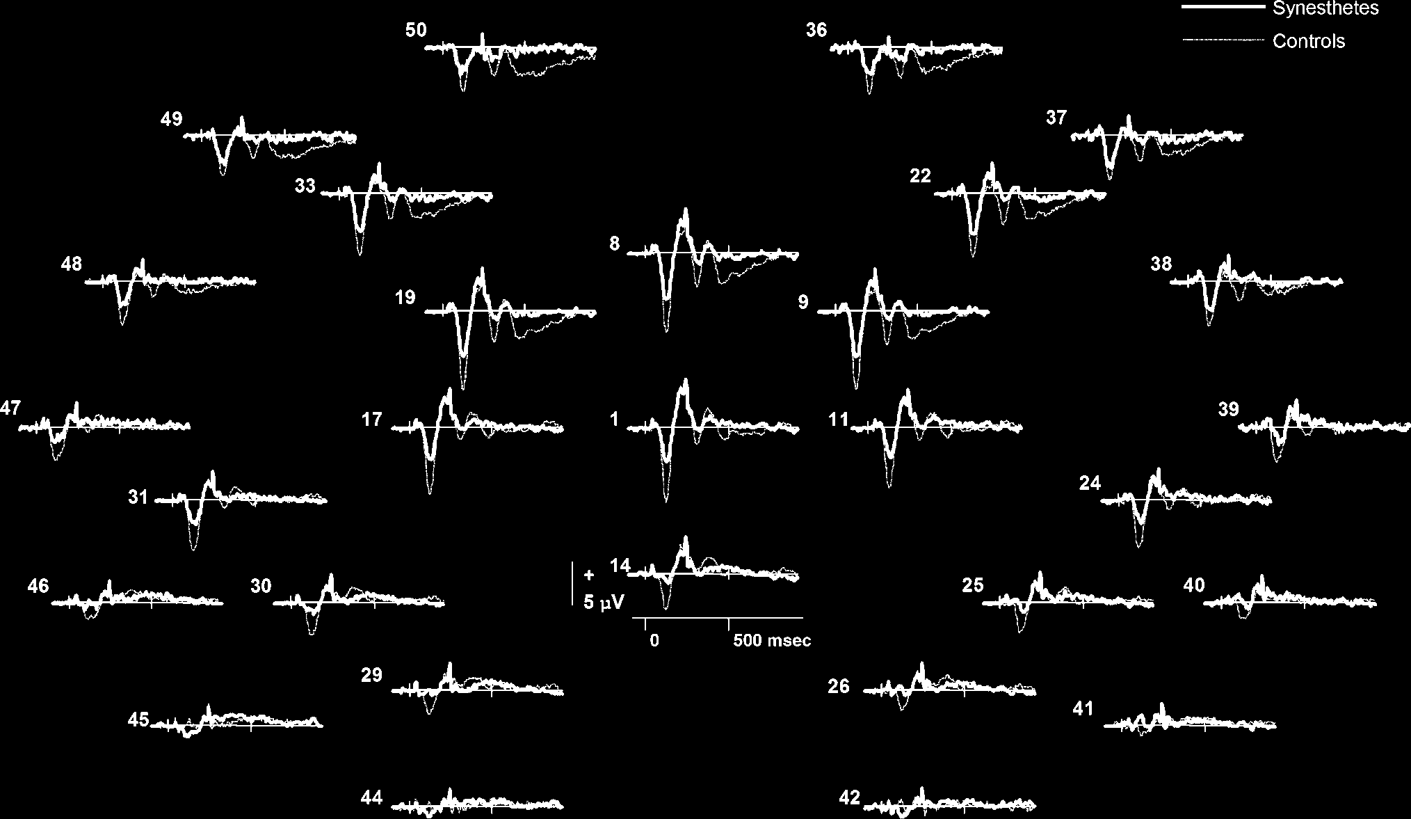 Seeing Sounds and Hearing Colors: An Event-related image