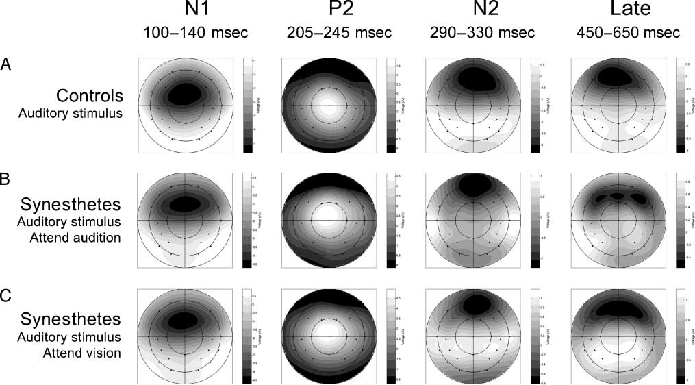 Seeing Sounds and Hearing Colors: An Event-related image