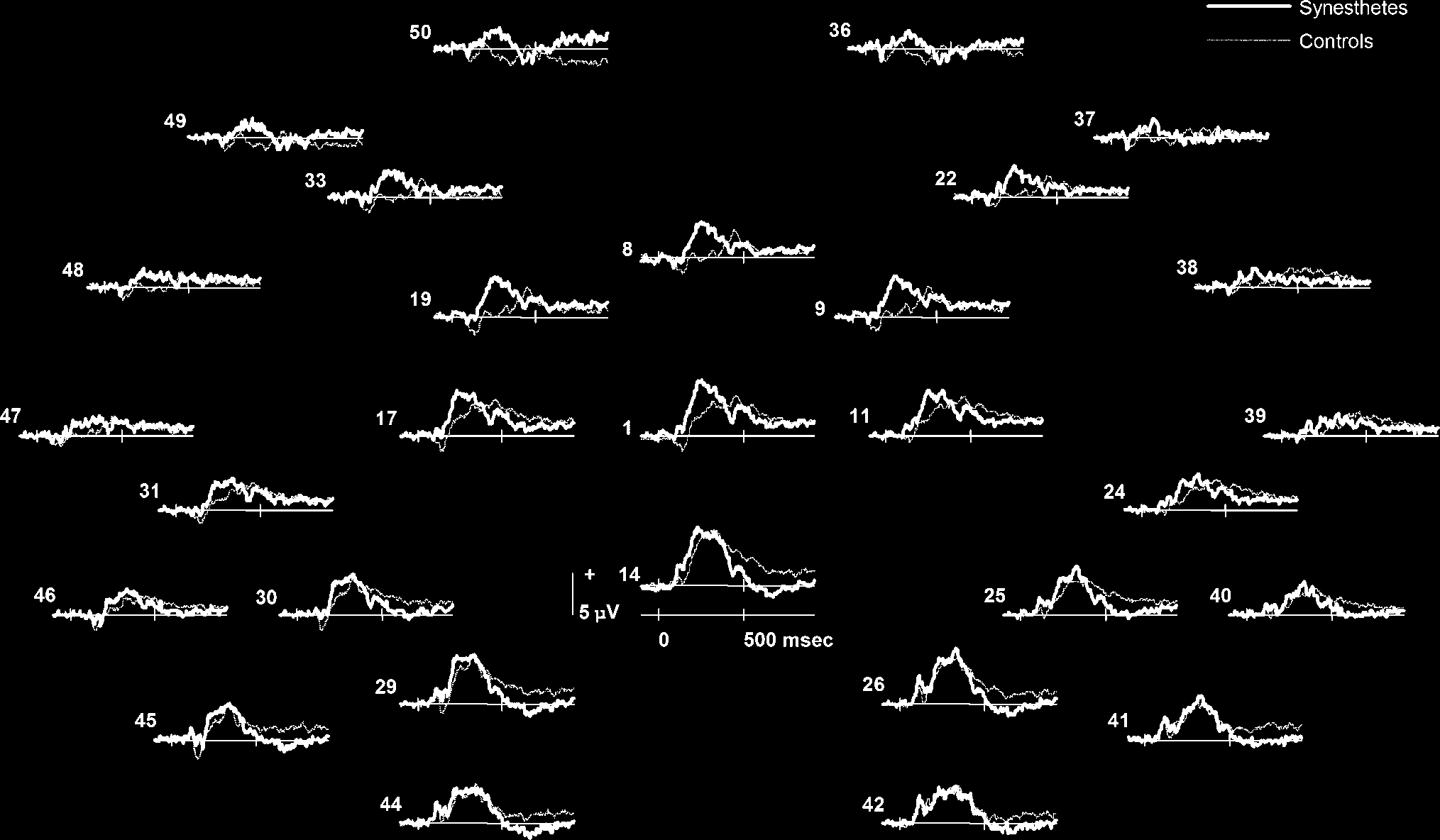 Seeing Sounds and Hearing Colors: An Event-related image