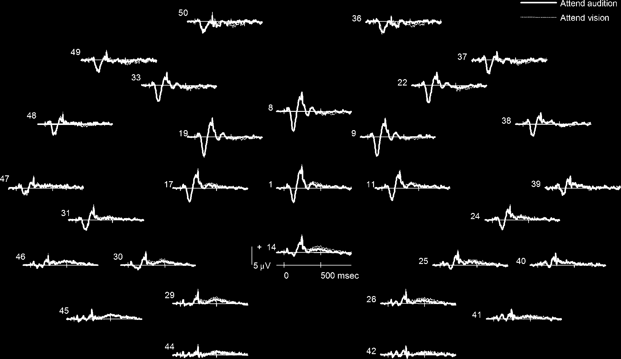 Seeing Sounds and Hearing Colors: An Event-related image