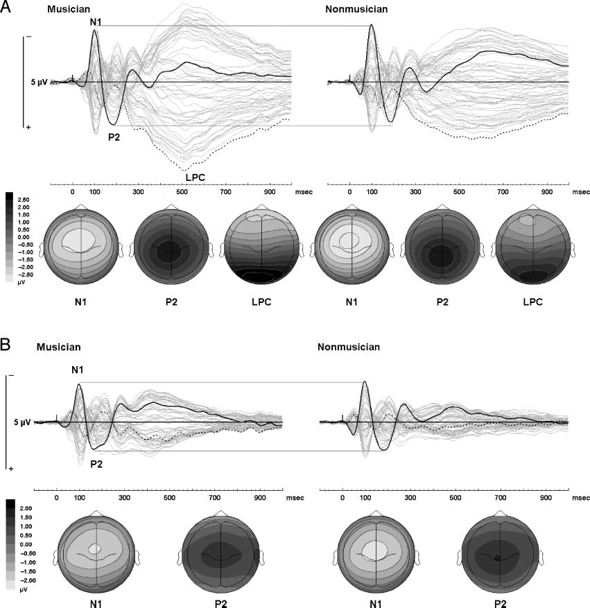 Concurrent Sound Segregation Is image