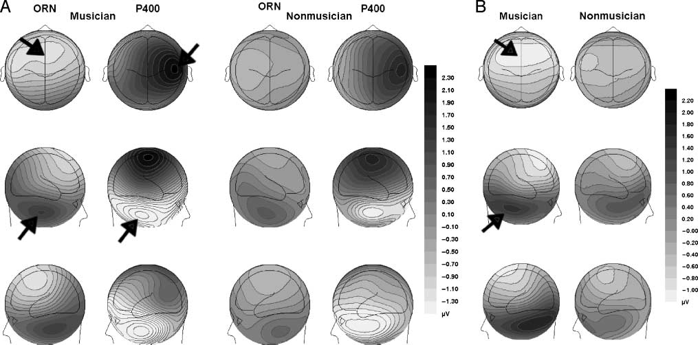 Concurrent Sound Segregation Is image