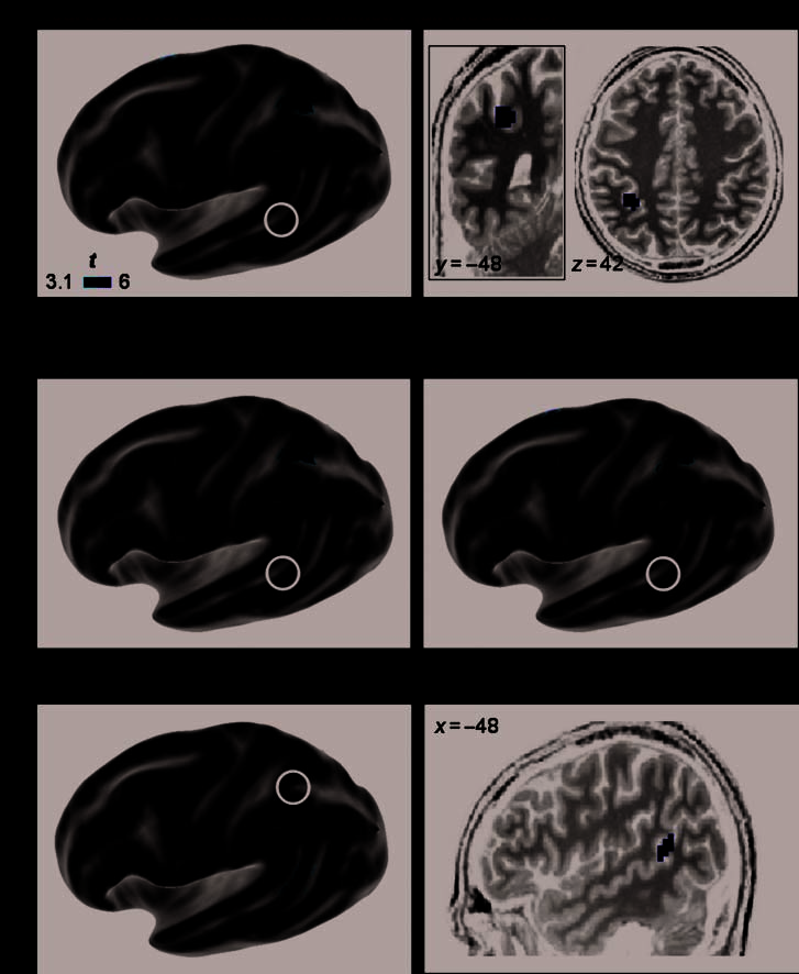 Beyond Hemispheric Dominance: Brain Regions image