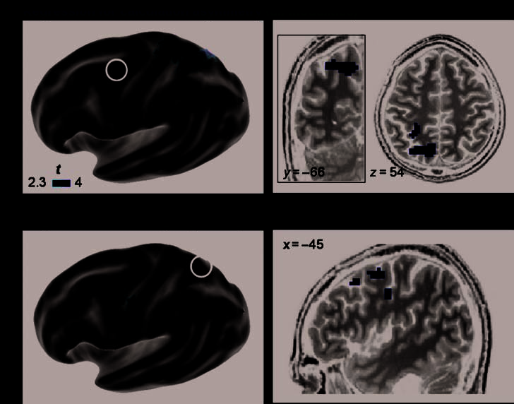 Beyond Hemispheric Dominance: Brain Regions image