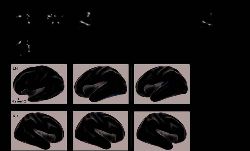 Beyond Hemispheric Dominance: Brain Regions image