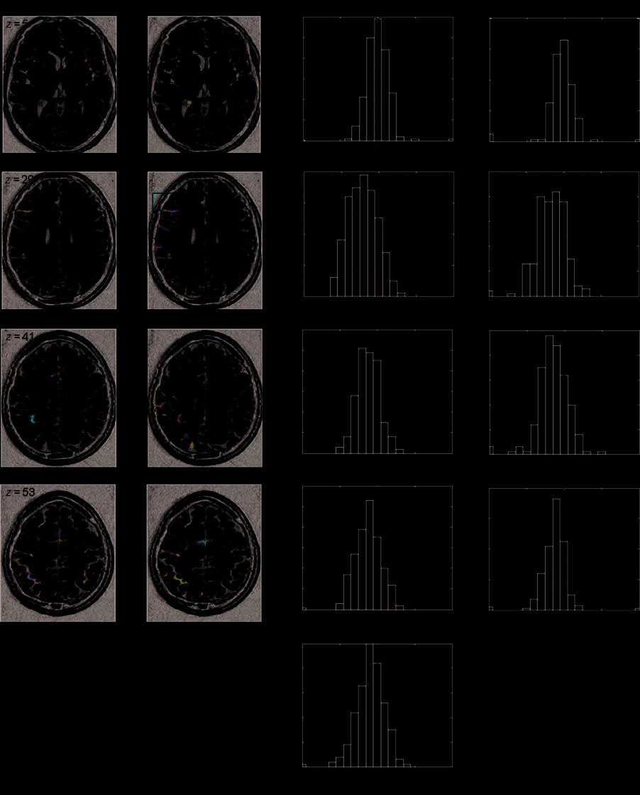 Beyond Hemispheric Dominance: Brain Regions image