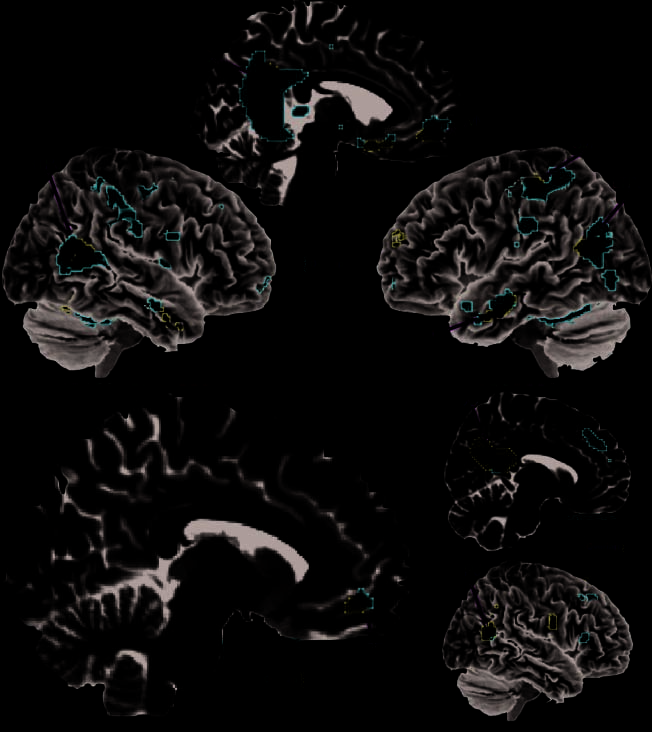 Shared Neural Circuits for Mentalizing about the image