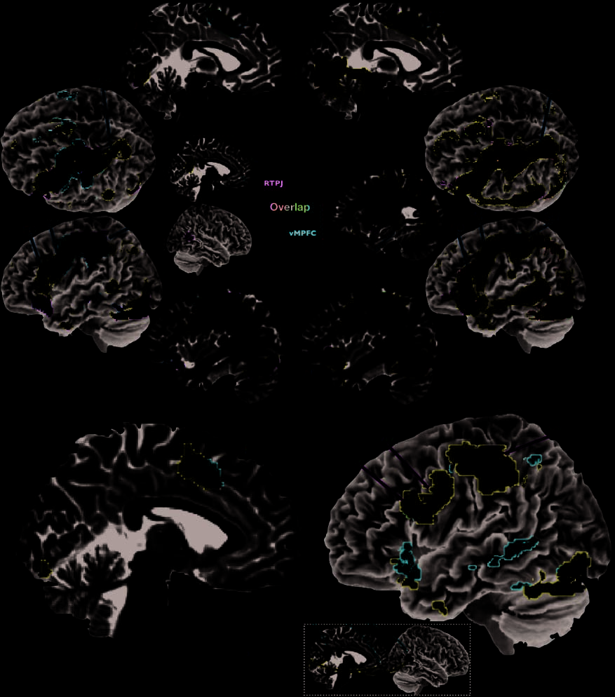 Shared Neural Circuits for Mentalizing about the image