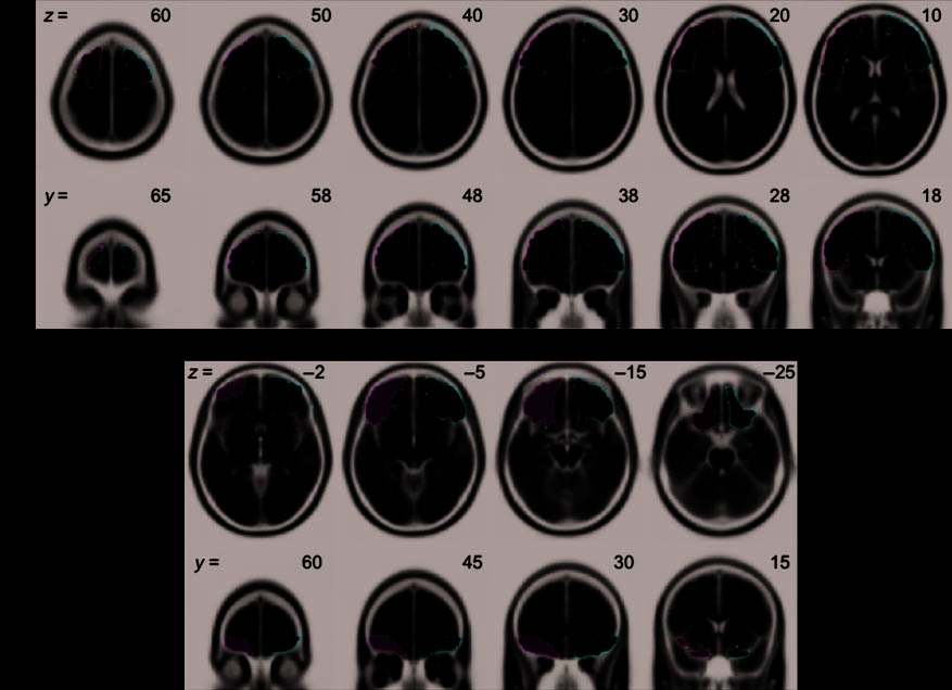 Approaching the Bad and Avoiding the Good: Lateral image