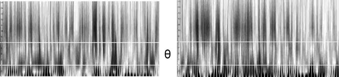 Cannabinoid Modulations of Resting State EEG Theta image