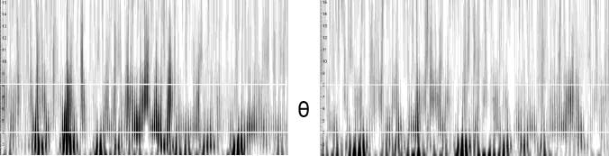 Cannabinoid Modulations of Resting State EEG Theta image