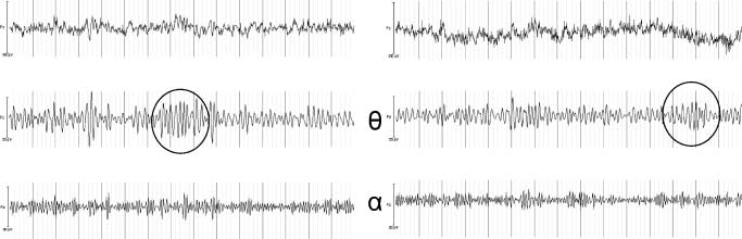 Cannabinoid Modulations of Resting State EEG Theta image