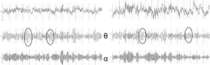 Cannabinoid Modulations of Resting State EEG Theta image